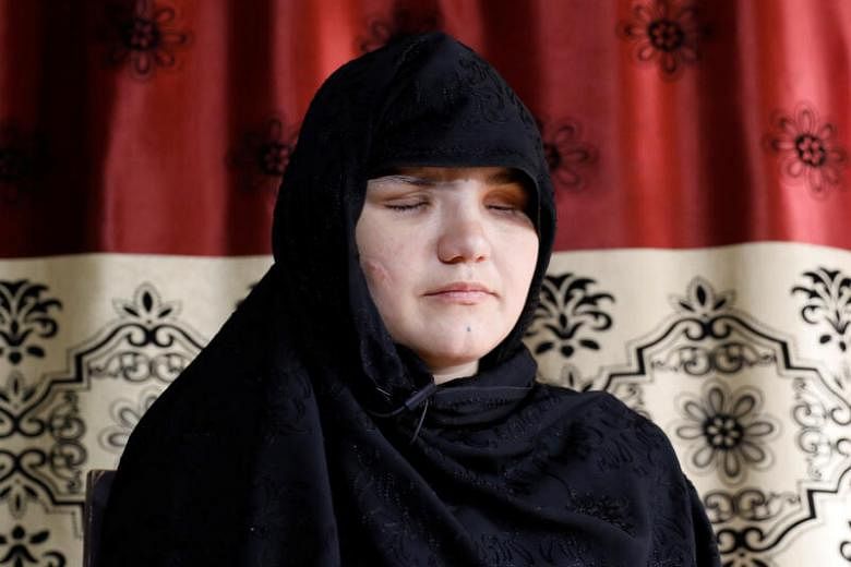 Wanita Afghanistan Ditembak, Dibutakan, Karena Mendapatkan Pekerjaan